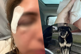 beykozda-bir-sokak-kopegi-saldirisi-daha